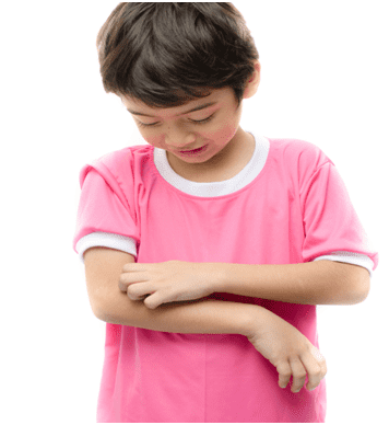 Комариный укус у ребенка фото
